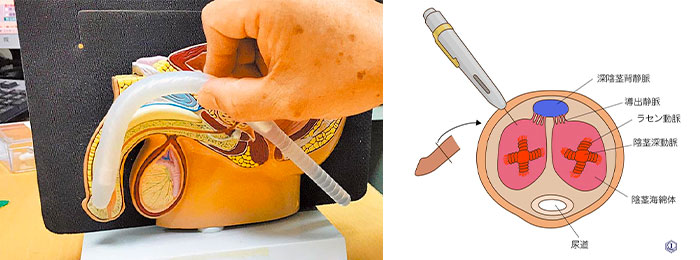 手術治療 手術治療